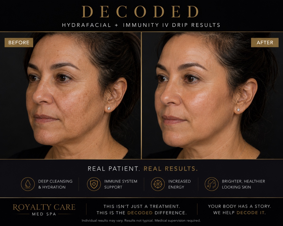 Royalty Care HydraFacial and immunity IV before and after: brighter, more hydrated skin in a real patient